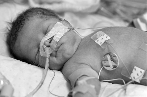 premature baby in ICU