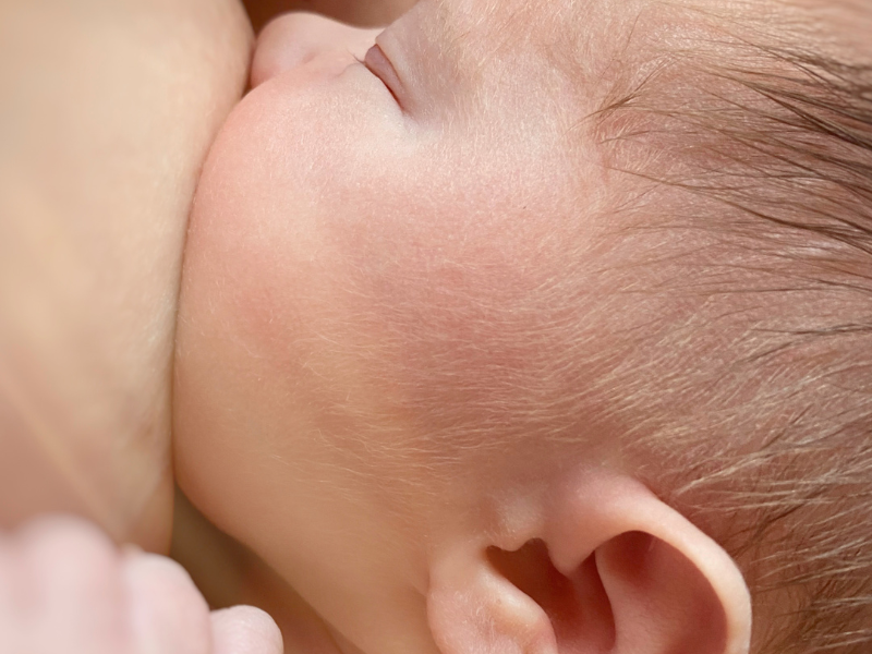 The Best Way to Treat a Nipple Bleb Naturally & Quickly