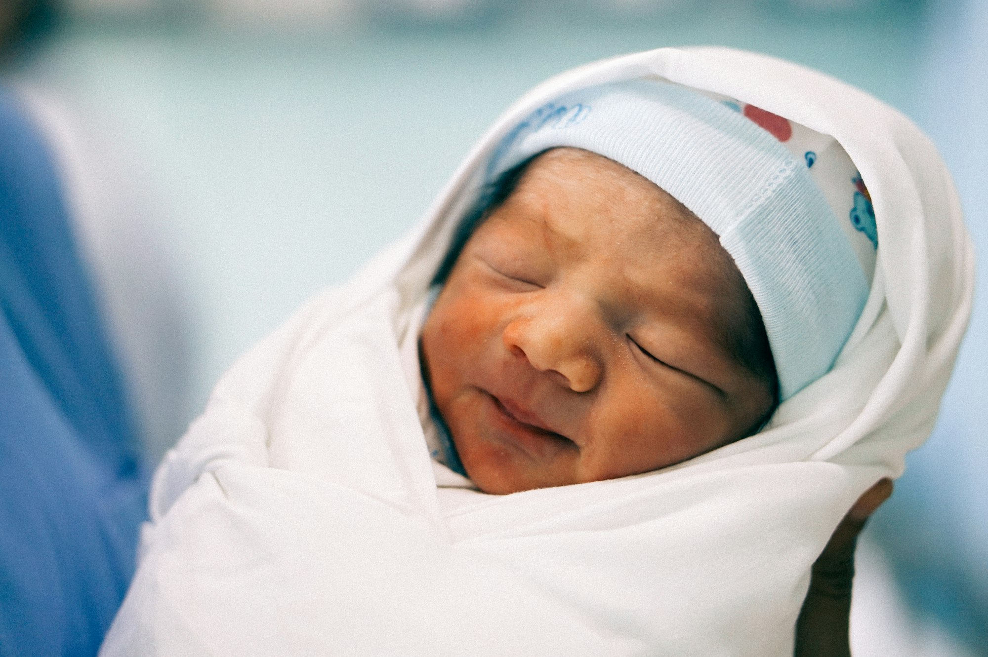 Breastfeeding and Jaundice