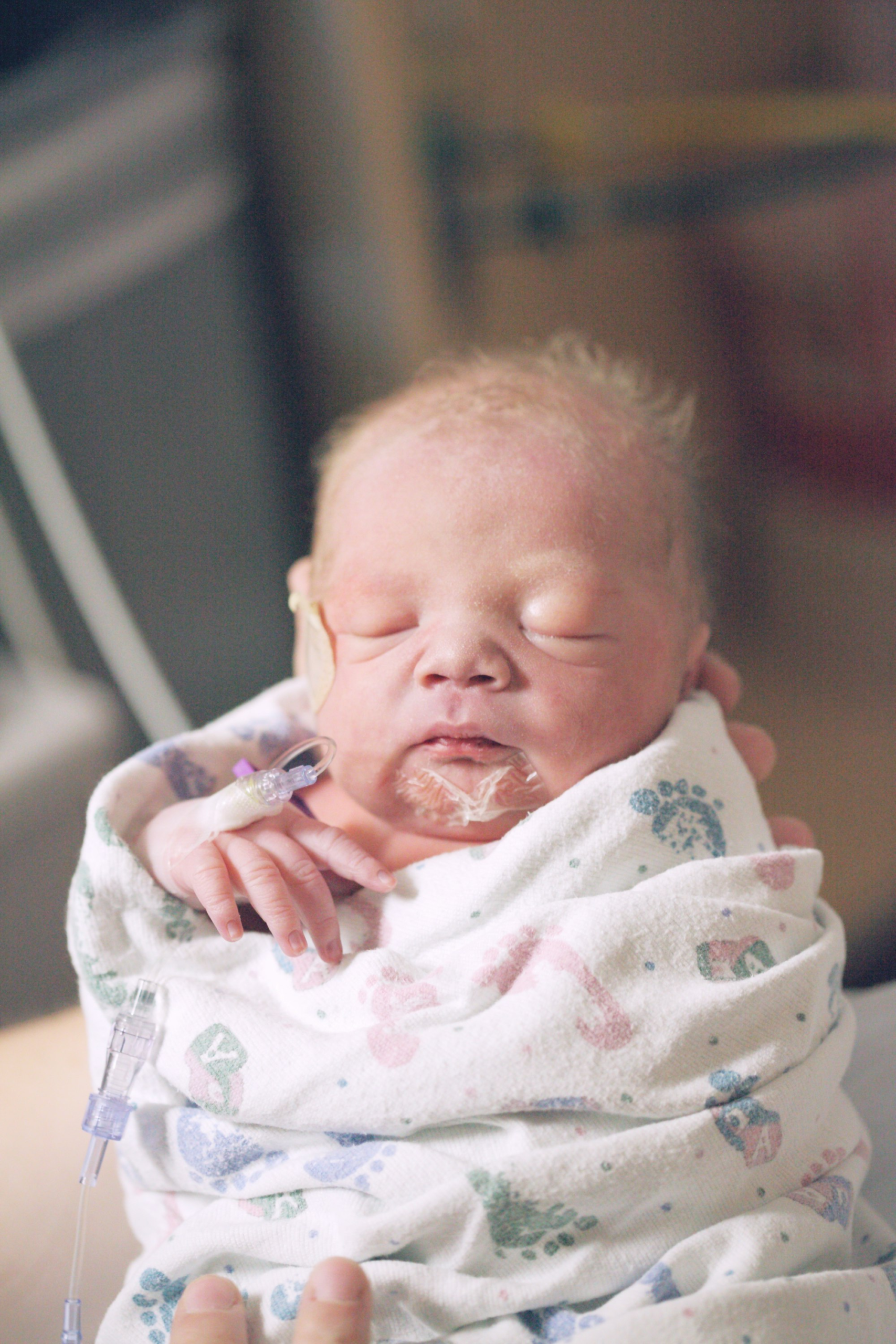 (KMC) Kangaroo Mother Care Benefits and Guide